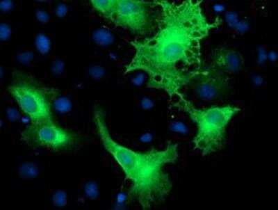 Immunocytochemistry/ Immunofluorescence: ErbB2/Her2 Antibody (OTI4F10) [NBP2-01152]
