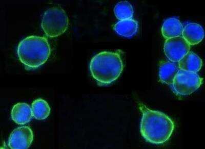 Immunocytochemistry/ Immunofluorescence: ErbB2/Her2 Antibody (511) [NBP2-89187]