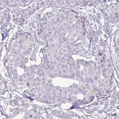 Immunohistochemistry-Paraffin: ErbB2/Her2 Antibody (CL0268) [NBP2-52896]