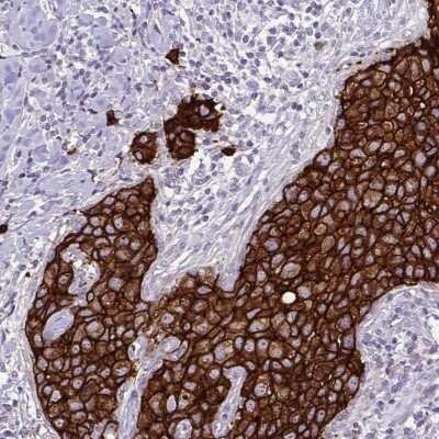 Immunohistochemistry-Paraffin: ErbB2/Her2 Antibody (CL0268) [NBP2-52896]