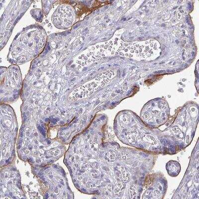 Immunohistochemistry-Paraffin: ErbB2/Her2 Antibody (CL0268) [NBP2-52896]