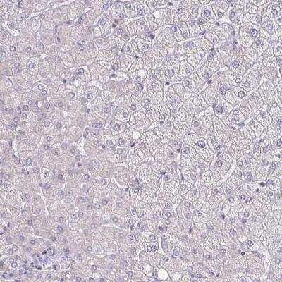 Immunohistochemistry-Paraffin: ErbB2/Her2 Antibody (CL0268) [NBP2-52896]