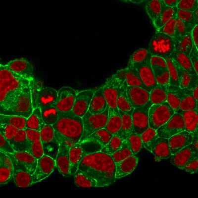 Immunocytochemistry/ Immunofluorescence: ErbB2/Her2 Antibody (ERB2/776) - Azide and BSA Free [NBP2-48004]