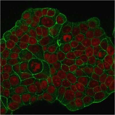 Immunocytochemistry/ Immunofluorescence: ErbB2/Her2 Antibody (ERB2/776) [NBP2-44983]