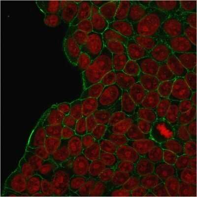 Immunocytochemistry/ Immunofluorescence: ErbB2/Her2 Antibody (HRB2/273) - Azide and BSA Free [NBP2-48005]