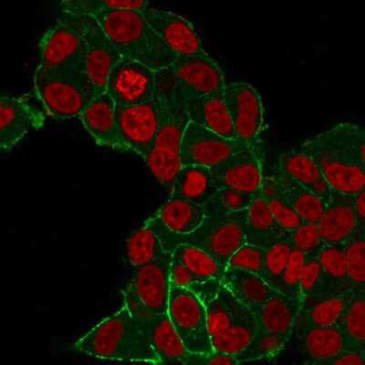 Immunocytochemistry/ Immunofluorescence: ErbB2/Her2 Antibody (HRB2/282) [NBP2-32863]