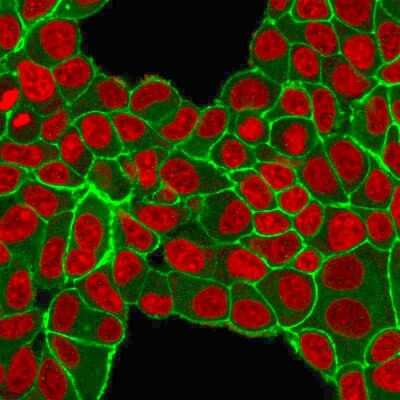 Immunocytochemistry/ Immunofluorescence: ErbB2/Her2 Antibody (HRB2/451) - Azide and BSA Free [NBP2-33064]