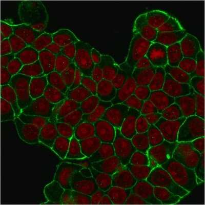 Immunocytochemistry/ Immunofluorescence: ErbB2/Her2 Antibody (HRB2/451) [NBP2-29437]