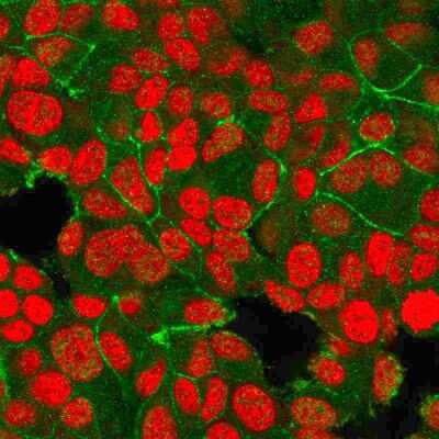 Immunocytochemistry/ Immunofluorescence: ErbB2/Her2 Antibody (HRB2/718) - Azide and BSA Free [NBP2-34643]