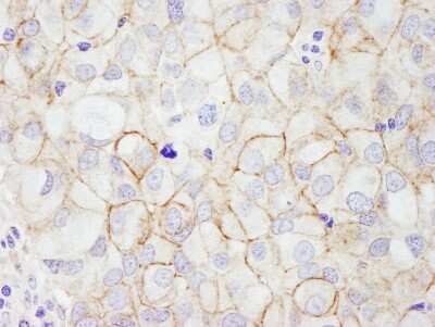 Immunohistochemistry-Paraffin: ErbB2/Her2 Antibody [NB100-1710]