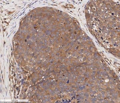 Immunohistochemistry-Paraffin: ErbB2/Her2 Antibody - BSA Free [NBP2-29624]