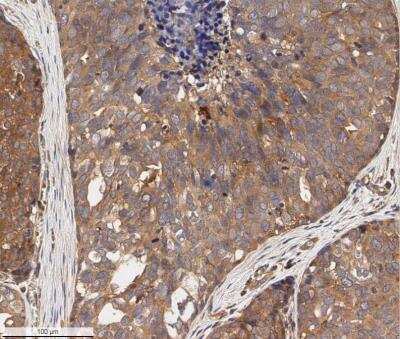 Immunohistochemistry-Paraffin: ErbB2/Her2 Antibody - BSA Free [NBP2-29624]