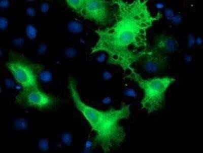 Immunocytochemistry/ Immunofluorescence: ErbB2/Her2 Antibody (OTI4F10) - Azide and BSA Free [NBP2-70653]