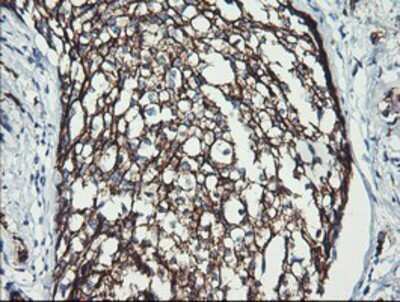Immunohistochemistry: ErbB2/Her2 Antibody (OTI4F10) - Azide and BSA Free [NBP2-70653]