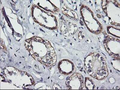 Immunohistochemistry: ErbB2/Her2 Antibody (OTI4F10) - Azide and BSA Free [NBP2-70653]