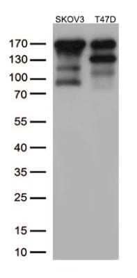 Western Blot: ErbB2/Her2 Antibody (OTI4F10)Azide and BSA Free [NBP2-70653]