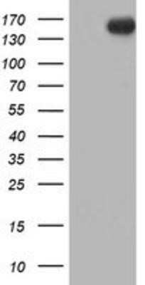 Western Blot: ErbB2/Her2 Antibody (OTI4F10)Azide and BSA Free [NBP2-70653]