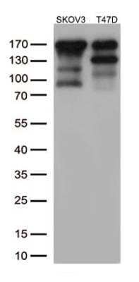 Western Blot: ErbB2/Her2 Antibody (OTI4F10) [NBP2-01152]