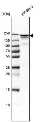 Western Blot: ErbB2/Her2 Antibody [NBP1-84584]