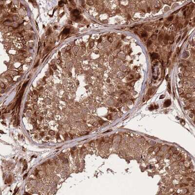 Immunohistochemistry: ErbB3/Her3 Antibody [NBP2-33289]