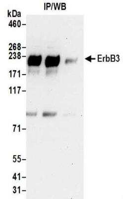 Immunoprecipitation: ErbB3/Her3 Antibody [NBP2-32253]