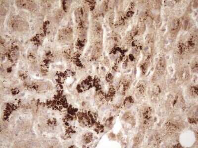Immunohistochemistry: ErbB3/Her3 Antibody (OTI3E10) - Azide and BSA Free [NBP2-70661]