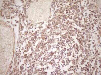 Immunohistochemistry: ErbB3/Her3 Antibody (OTI3E10) - Azide and BSA Free [NBP2-70661]