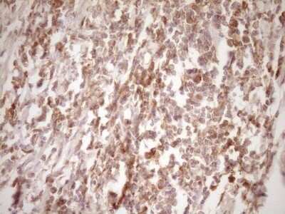 Immunohistochemistry: ErbB3/Her3 Antibody (OTI3E10) - Azide and BSA Free [NBP2-70661]