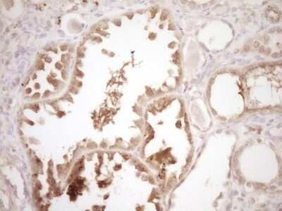 Immunohistochemistry: ErbB3/Her3 Antibody (OTI3E10) [NBP2-45481]