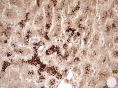 Immunohistochemistry: ErbB3/Her3 Antibody (OTI3E10) [NBP2-45481]