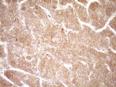 Immunohistochemistry: ErbB3/Her3 Antibody (OTI3E10) [NBP2-45481]