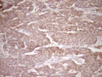 Immunohistochemistry: ErbB3/Her3 Antibody (OTI3E10) [NBP2-45481]