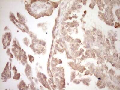 Immunohistochemistry: ErbB3/Her3 Antibody (OTI3E10) [NBP2-45481]