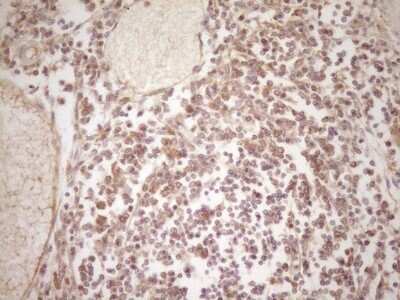 Immunohistochemistry: ErbB3/Her3 Antibody (OTI3E10) [NBP2-45481]