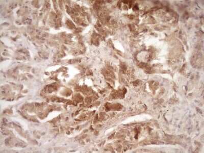 Immunohistochemistry: ErbB3/Her3 Antibody (OTI3E10) [NBP2-45481]