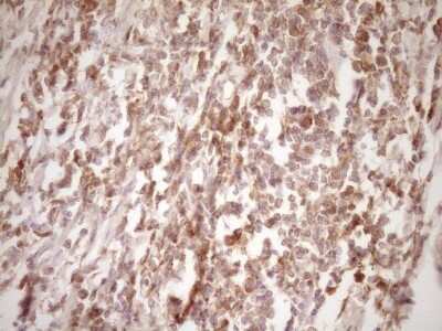 Immunohistochemistry-Paraffin: ErbB3/Her3 Antibody (OTI3E10) [NBP2-45481]