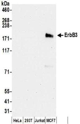 Western Blot: ErbB3/Her3 Antibody [NBP2-32253]