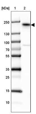 Western Blot: ErbB3/Her3 Antibody [NBP2-33289]