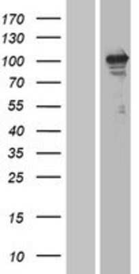 Western Blot: ErbB3/Her3 Overexpression Lysate [NBP2-04209]