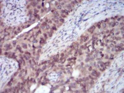 Immunohistochemistry-Paraffin: ErbB4/Her4 Antibody (5G6B4) - BSA Free [NBP2-52462]