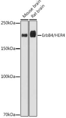 Western Blot: ErbB4/Her4 Antibody (8E5D0) [NBP3-15632]