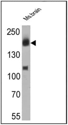 Western Blot: ErbB4/Her4 Antibody (H4.77.16 (Ab77)) [NB120-3104]