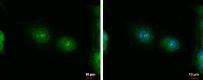 Immunocytochemistry/ Immunofluorescence: ErbB4/Her4 Antibody [NBP1-33120]