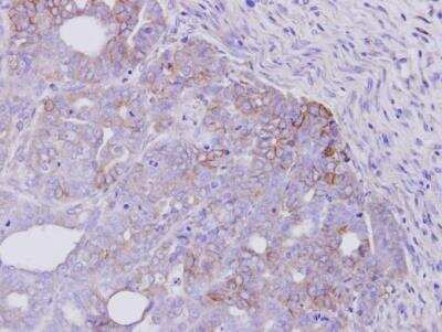 Immunohistochemistry-Paraffin: ErbB4/Her4 Antibody [NBP1-33120]