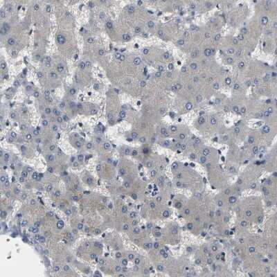 Immunohistochemistry-Paraffin: ErbB4/Her4 Antibody [NBP1-90371]