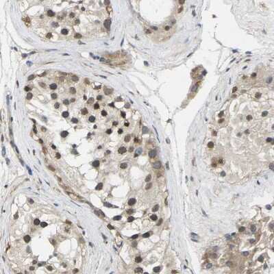 Immunohistochemistry-Paraffin: ErbB4/Her4 Antibody [NBP1-90371]