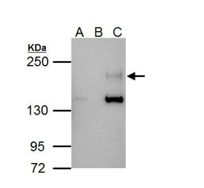 Immunoprecipitation: ErbB4/Her4 Antibody [NBP1-33120]