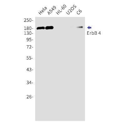 Western Blot: ErbB4/Her4 Antibody (S07-2H1) [NBP3-15027]