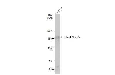 Western Blot: ErbB4/Her4 Antibody [NBP1-33120]