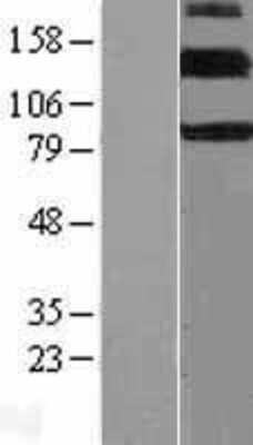 Western Blot: ErbB4/Her4 Overexpression Lysate [NBL1-10317]